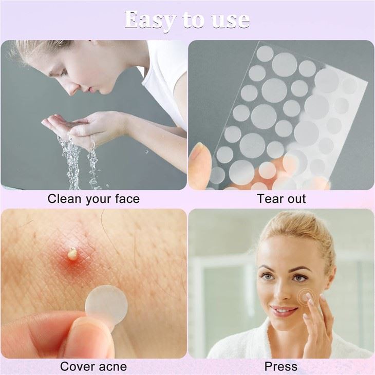 acne spot patches